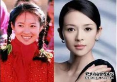在整形手术前她没有点燃火焰，在她的脸完全僵