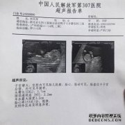 NT值范围正常吗？