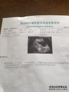 什么是子宫胶囊？