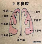 我用仪器洗鼻子。当我洗净时，水直接从鼻孔流