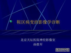 如何造成占用椅子和椅子空间的伤害。