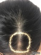 宝宝的头怎么样？