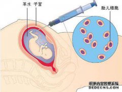 [羊水浊度如何影响胎儿？]