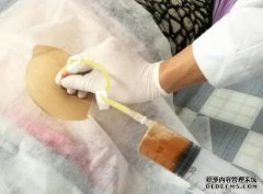 当前的门诊腹水肝手术：2周后检查