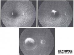[牙髓的治疗]